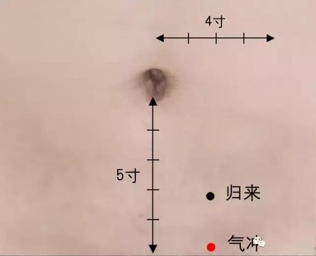 　一艾灸就上火，這是為什么?