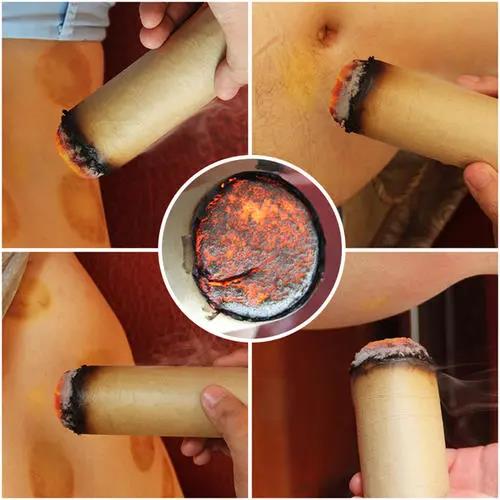 灸溫，到底是燙的好還是溫的好？為什么有的人感覺不到熱?