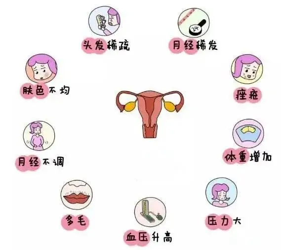 10個女人就有1個患多囊！被它纏上不要怕，艾灸幫你調(diào)“多囊”！